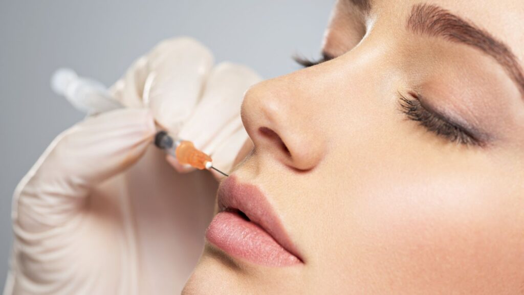 Close-up of a Botox injection being administered to the upper lip during a Lip Flip procedure.